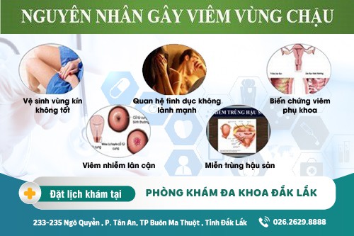 Chữa viêm vùng chậu Đắk Lắk – Nguyên nhân gây viêm vùng chậu là gì?