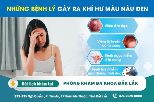 Chữa khí hư bất thường Đắk Lắk – Khí hư màu nâu đen cảnh báo bệnh gì?