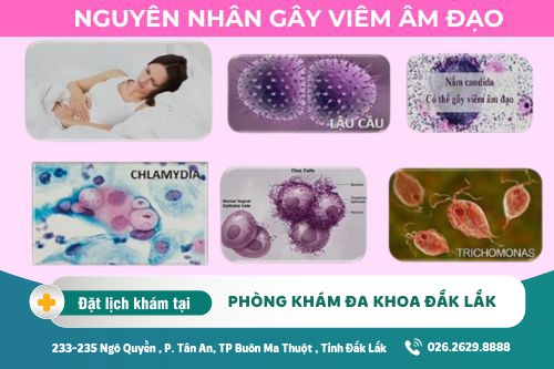 Chữa viêm âm đạo Đắk Lắk - Chi phí và phương pháp điều trị như thế nào?