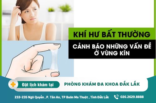 Cách chữa khí hư bất thường Đắk Lắk - Khí hư bất thường cảnh báo bệnh gì?