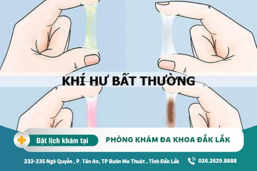 Chữa bệnh khí hư Đắk Lắk - Khí hư bất thường nguyên nhân do đâu?