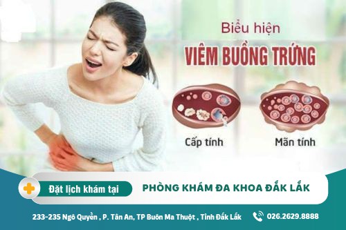 Chữa viêm buồng trứng Đắk Lắk - Viêm buồng trứng nguyên nhân do đâu?