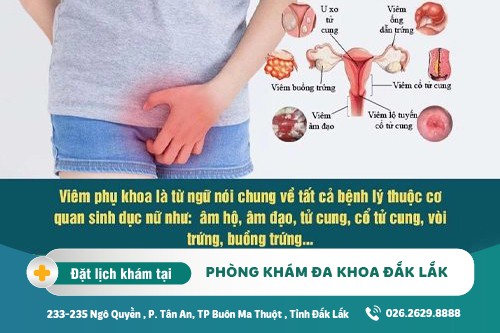 Điều trị viêm âm đạo Đắk Lắk – Chi phí trị viêm âm đạo là bao nhiêu?