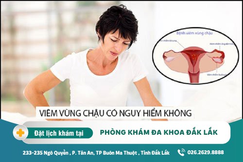 Điều trị viêm vùng chậu Đắk Lắk – Viêm vùng chậu có nguy hiểm không?