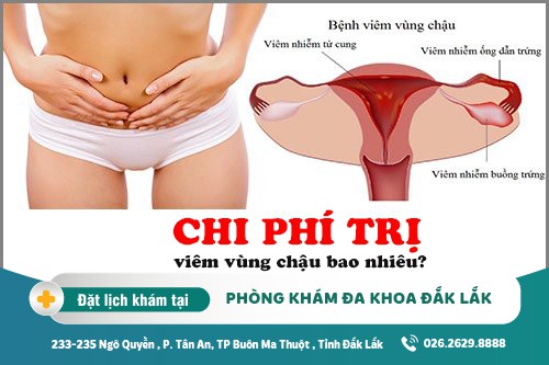 Cách chữa viêm vùng chậu Đắk Lắk – Chi phí trị viêm vùng chậu bao nhiêu?