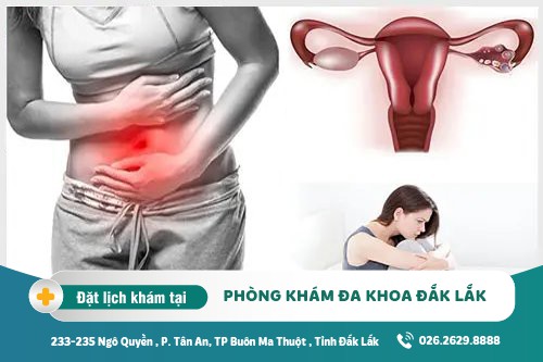 Cách trị viêm buồng trứng Đắk Lắk – Chi phí điều trị bao nhiêu?