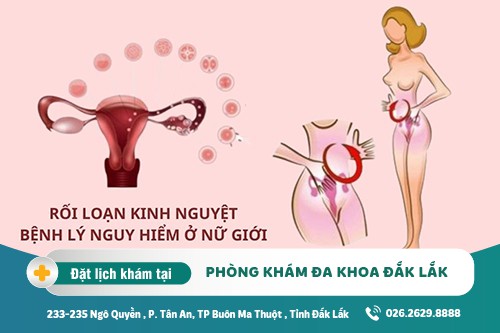 Chữa rối loạn kinh nguyệt Đắk Lắk – Rối loạn kinh nguyệt có nguy hiểm không?